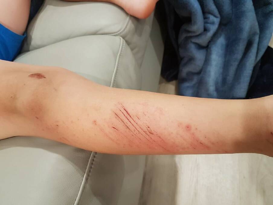 Images of a child's injuries in an incident raised with the directorate in March 2018. Photo: Supplied