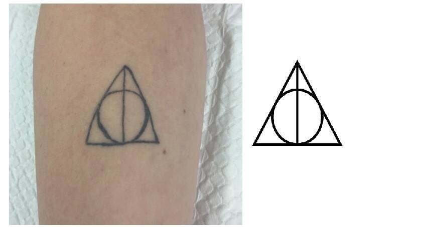 A wonky Harry Potter symbol that was removed, next to a straighter version of the symbol.