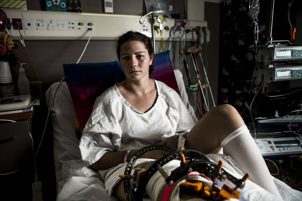 Nikki Ayers had 10 operations in 21 days when she was first taken to hospital in 2016. Photo: Jamila Toderas