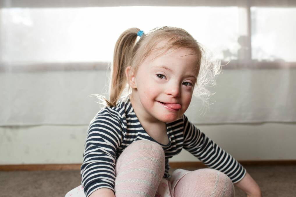 Three-year-old Olivia Ross has down syndrome as well as development issues such as difficulty swallowing after being born premature. She is about to miss out on early intervention therapies due to cuts to her NDIS support package.  Photo: Jamila Toderas