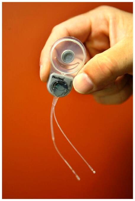 A Cochlear Implant  Photo: Craig Abraham