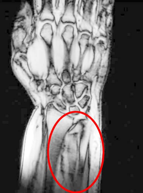The face discovered in an MRI of Eden O’Mara’s hand. Photo: Supplied