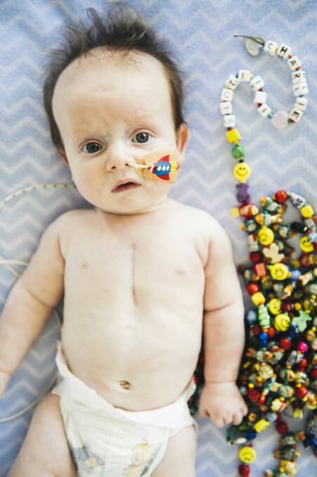 Three-month-old Charlie Clode has a complex heart condition. Each 300 bead represents a medical incident, but the smileys show "good days". Photo: Rohan Thomson
