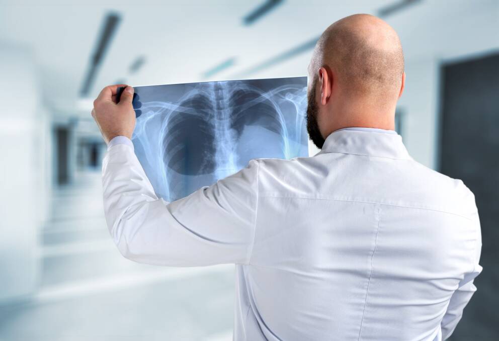 Lung cancer is one of the most aggressive forms of cancer. Photo: Supplied