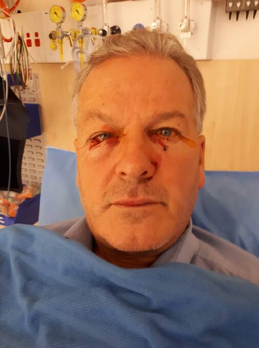 Bus driver Billy Willox in hospital after he was attacked by a kangaroo.  Photo: Facebook.