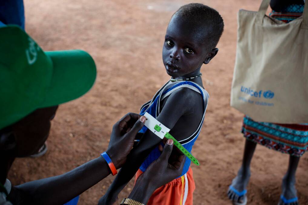 A boy having his arm measured to determine whether he is suffering malnutrition during a nutritional assessment at an emergency medical facility supported by UNICEF in Kuach, on the road to Leer, in South Sudan. Photo: Kate Holt/AP
