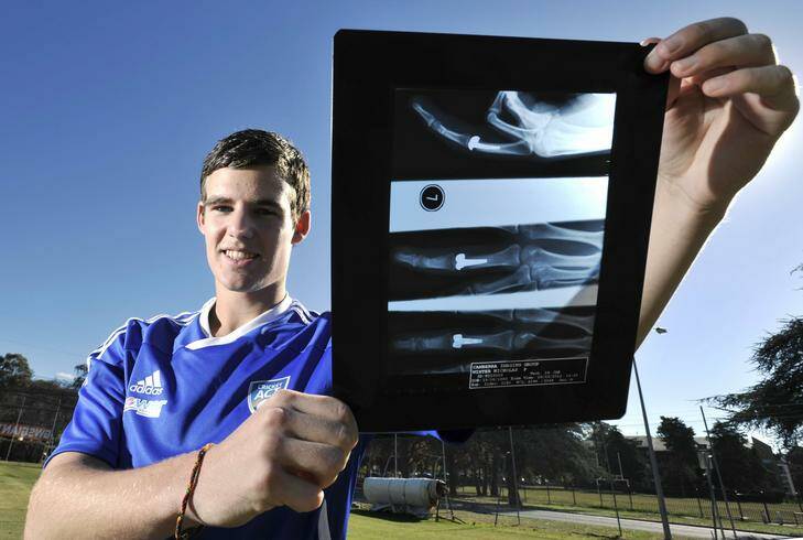 10 May 2012, Sport, Journalist  Chris Dutton Canberra Times PHOTO by JAY CRONAN.  ACT Comets Under 19 fast bowler Nick Winter is making a comeback after breaking his finger.  He will be playing cricket in Darwin over the winter in an effort to make it into the Australian under 19 team. Photo: Jay Cronan