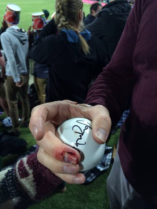 Tom Zouch's finger after catching a 'six' during the BBL half time show.