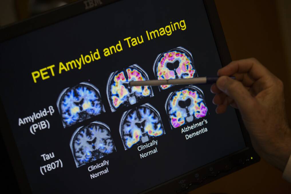 Nuclear medicine imaging helps experts observe functioning organs. Photo: AP