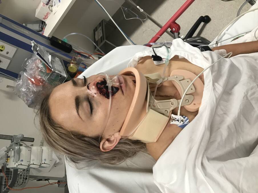 Caroline Buchanan in hospital in January after the crash. Photo: Supplied