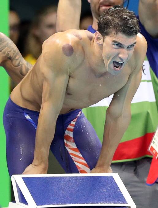 American star Michael Phelps was covered in cupping marks during the 4x100 metre freestyle relay in Rio. Photo: AP
