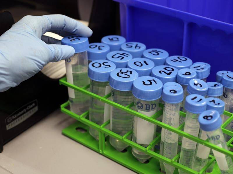 A trial will assess how stem cell therapy can improve life for kids with a rare genetic condition. (AP PHOTO)