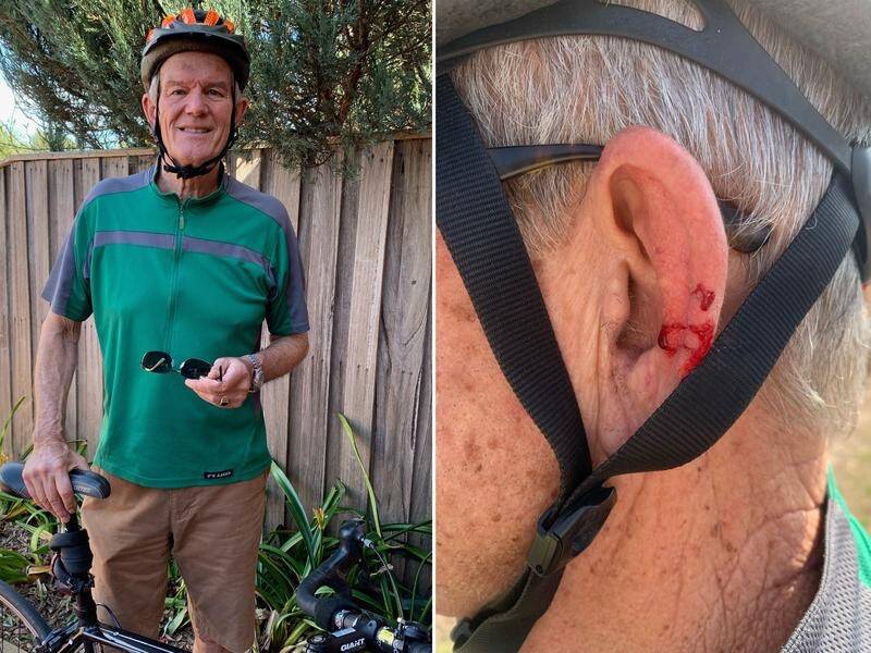 Christiaan Nyssen is urging cyclists to wear sunglasses to prevent magpies targeting their eyes. (SUPPLIED/AAP IMAGE)
