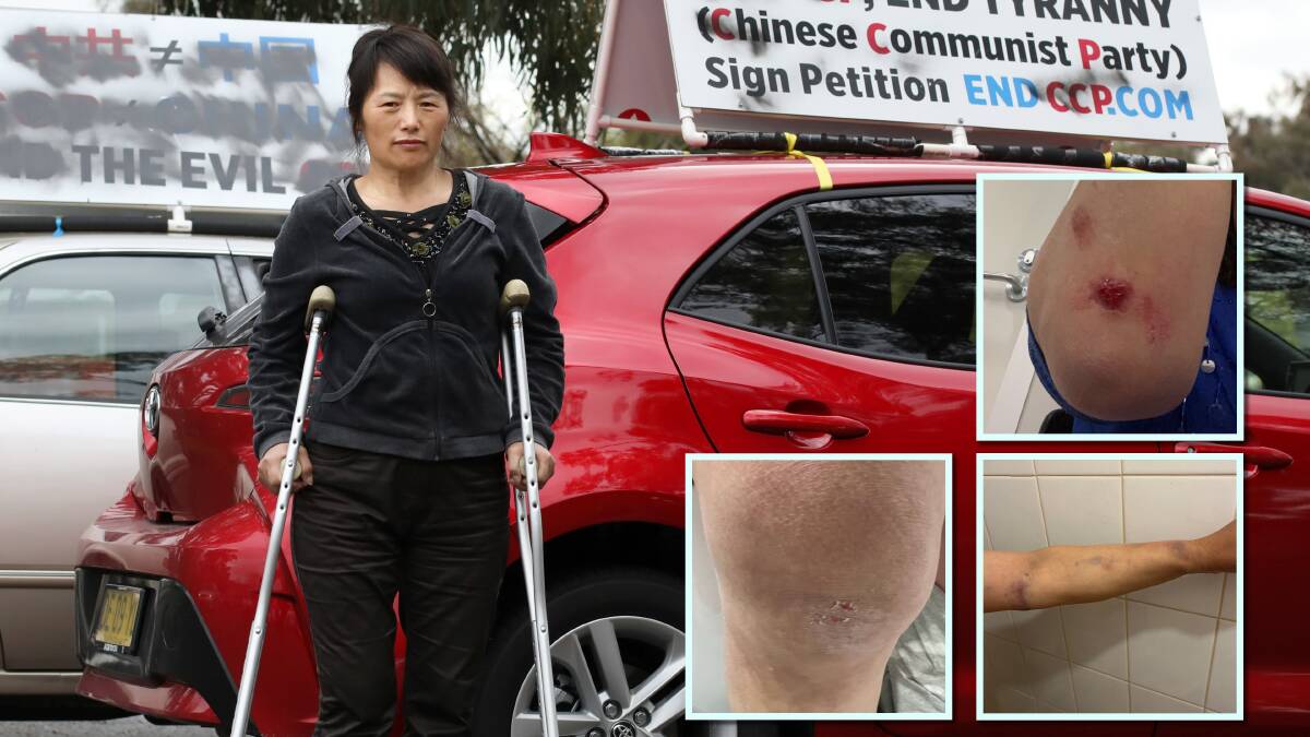 Alleged victim Nancy Dong standing beside cars with anti-Chinese communist party signs which were defaced and inset, the alleged injuries. Pictures by James Croucher, supplied 